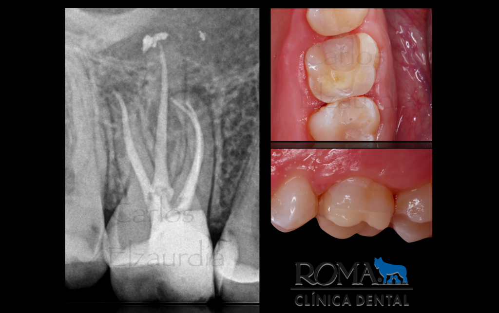 clínica dental roma