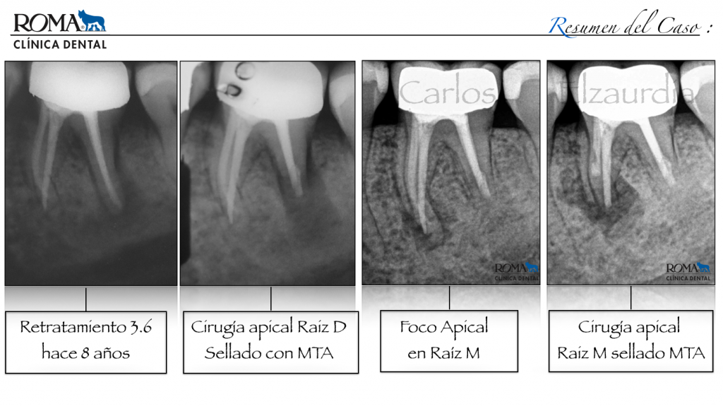 clínica dental roma