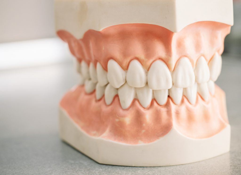 diseño de sonrisas 2