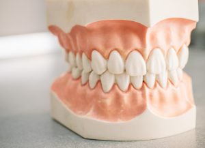 diseño de sonrisas 2